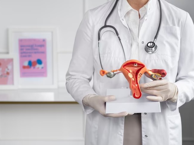 Tips Atasi Gejala PCOS (Sindrom Ovarium Polikistik) Tips Atasi Gejala PCOS (Sindrom Ovarium Polikistik)